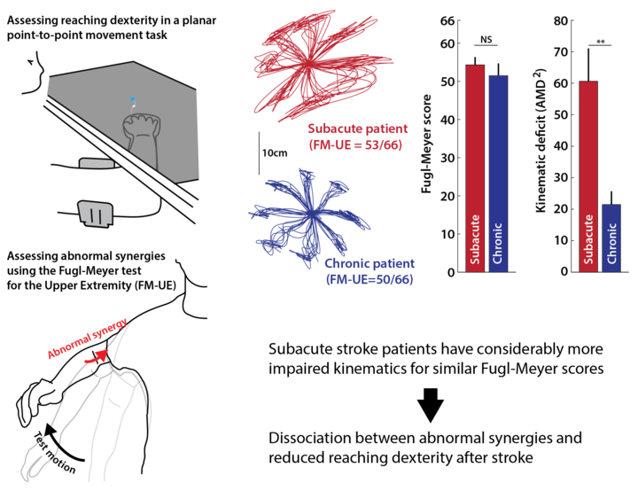 A graphical summary of my study showing a dissociation between abnormal synergies and dexterity after stroke